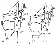 Fístulas, senos y quistes branquiales_1