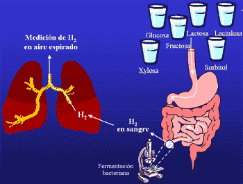 Test del aliento con hidratos de carbono