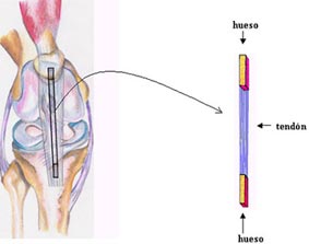 Hueso - Tendón - Hueso