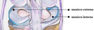 Menisco 2