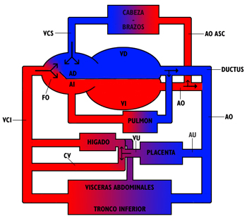 Cardiopatías congénita