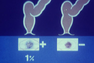 Prueba de sangre oculta en heces