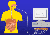 Manometría gastrointestinal